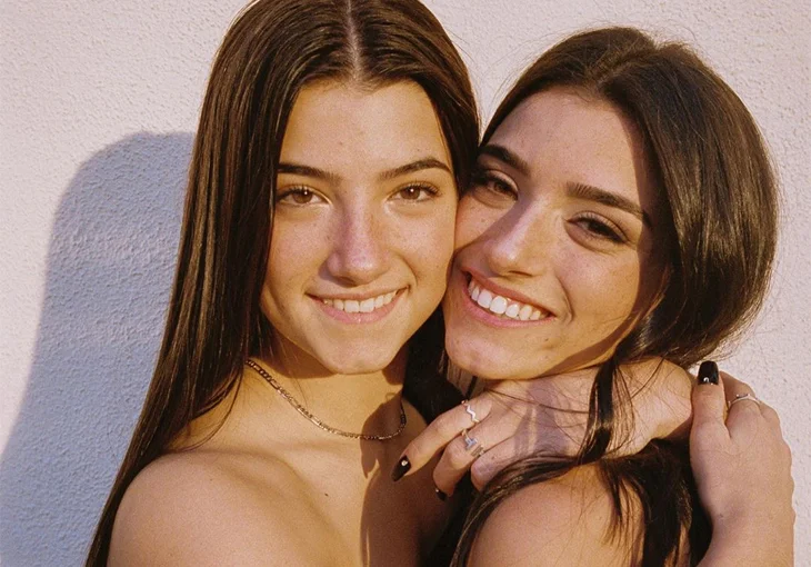 Qual a melhor e a pior parte de morar com a Charli D’Amelio? Dixie te conta!