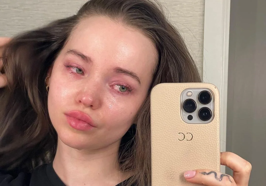 Dove Cameron preocupa fãs ao expor luta contra depressão e dismorfia de imagem
